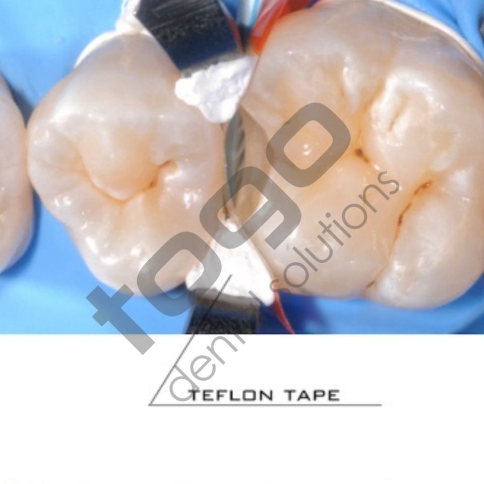 KSK Sectional Matrix (Böbrek Matris) Ring / Yüzük / Halka _ Tekli