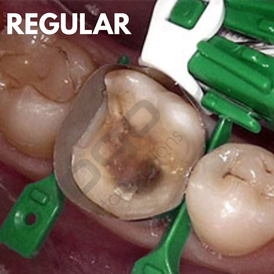 Rhondium QuickConnect Anatomy Band Intro Kit