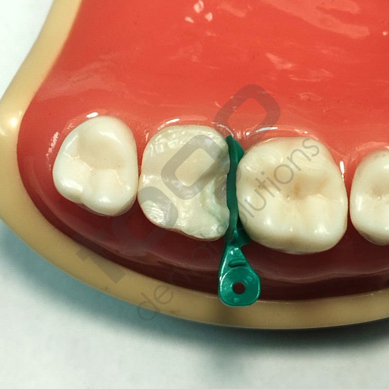 Rhondium Derin Marjin Kaması _ Küçük _ Premolar_ 50 Adet