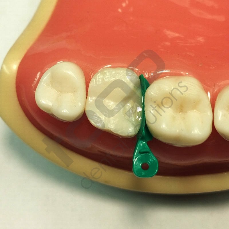 Rhondium Derin Marjin Kaması _ Küçük _ Premolar_ 50 Adet