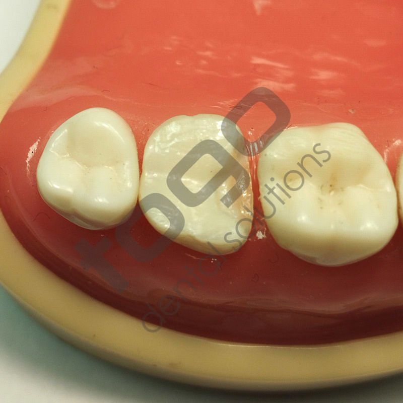 Rhondium Derin Marjin Kaması _ Set _ 100 Adet