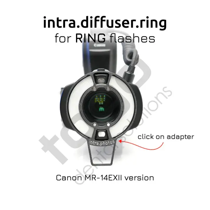 Intra Diffuser Kit _ Ring Flash
