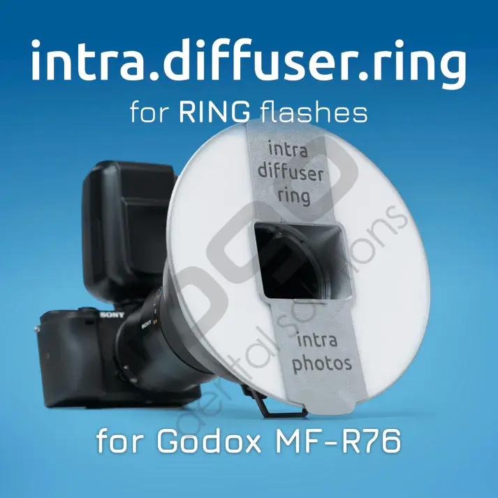 Intra Diffuser Kit _ Ring Flash