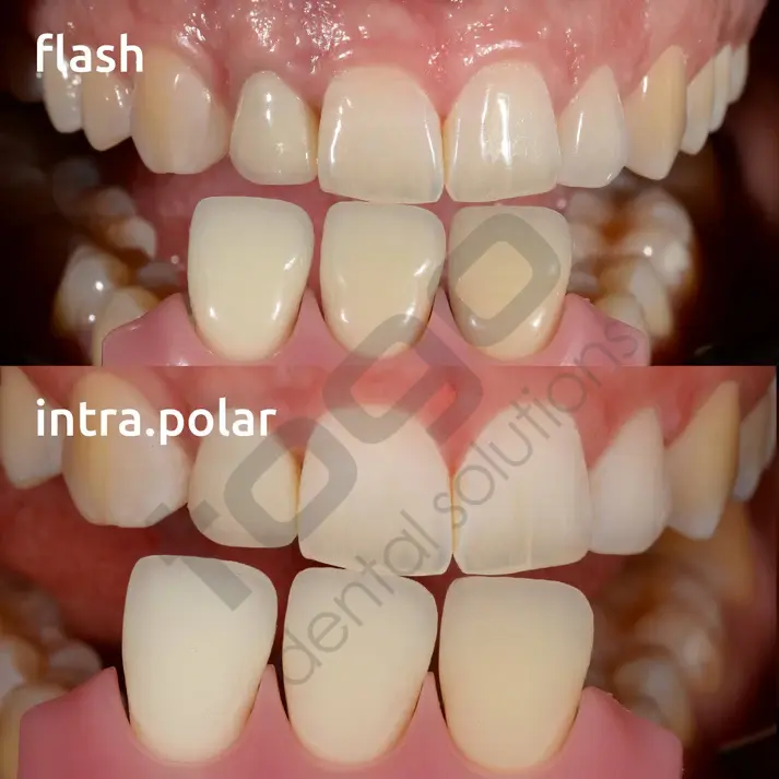 Intra Cross Polar Kit _ Twin Flash _ Çapraz Polarize Set