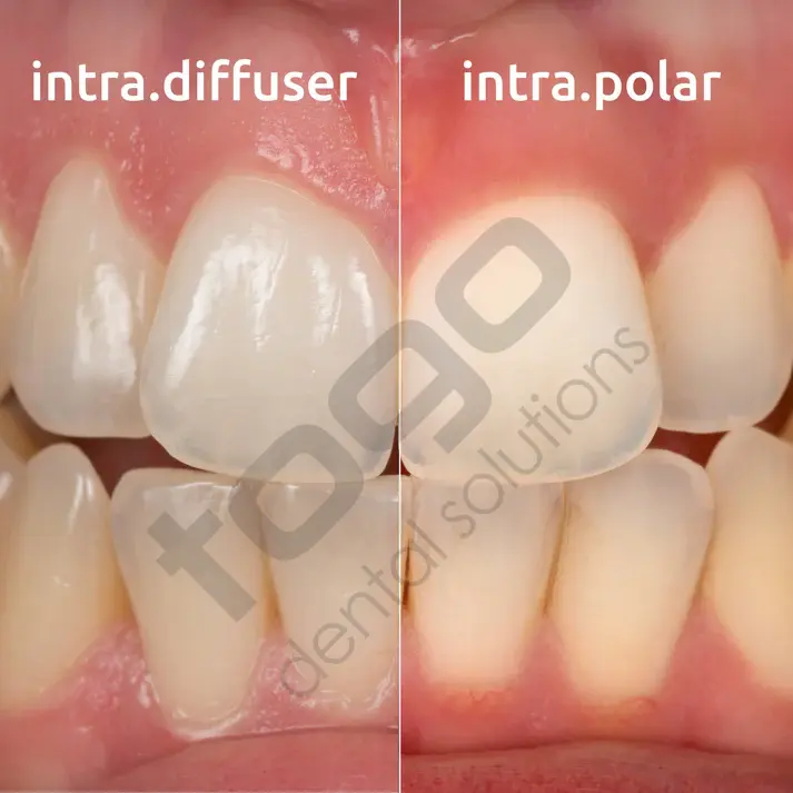 Intra Diffuser & Polar Kit _ Twin Flash