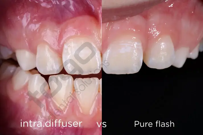 Intra Diffuser & Polar Kit _ Twin Flash