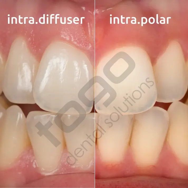 Intra Polar Kit _ Ring Flash