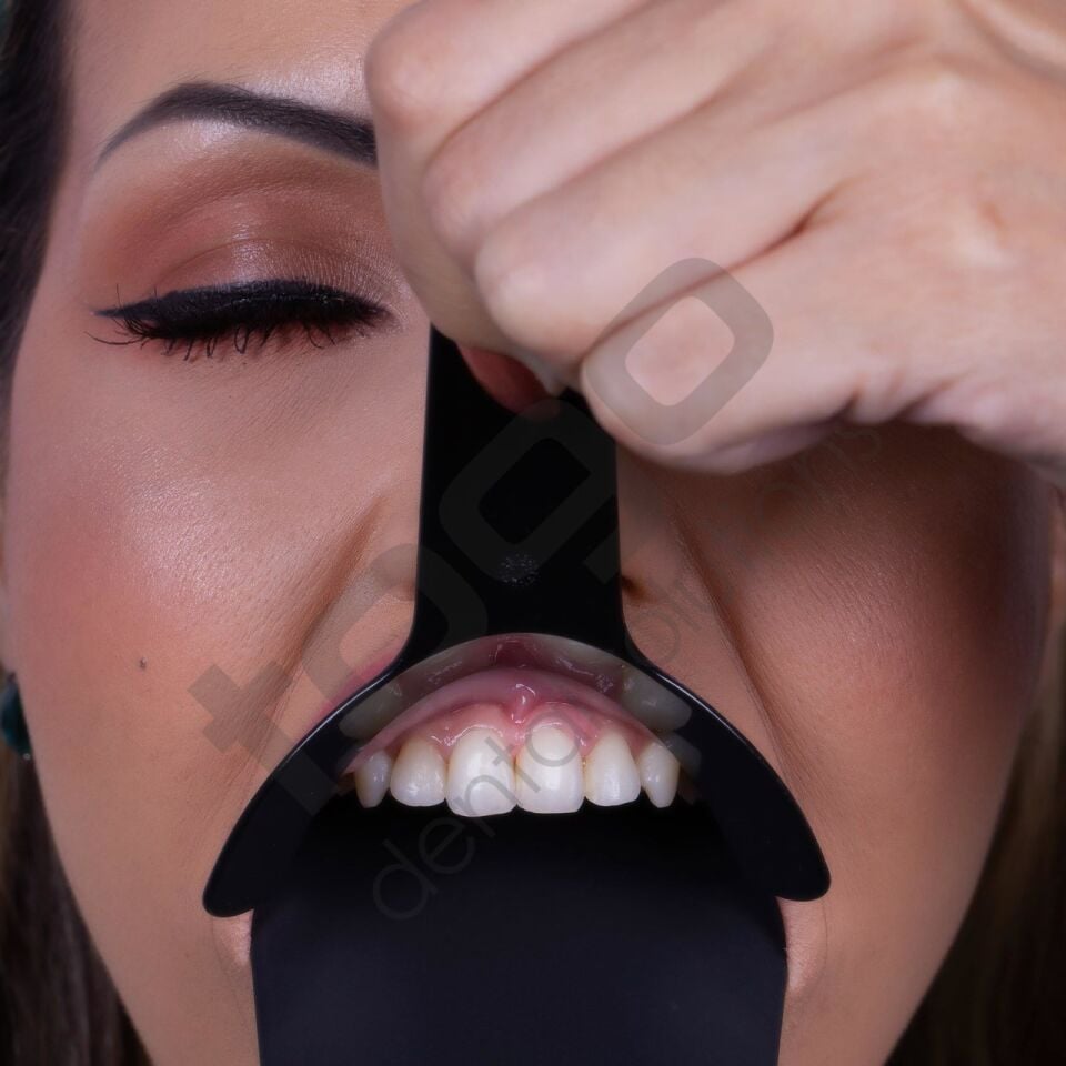 Indusbello Dental Fotoğrafçılık Ekartör Model:MF