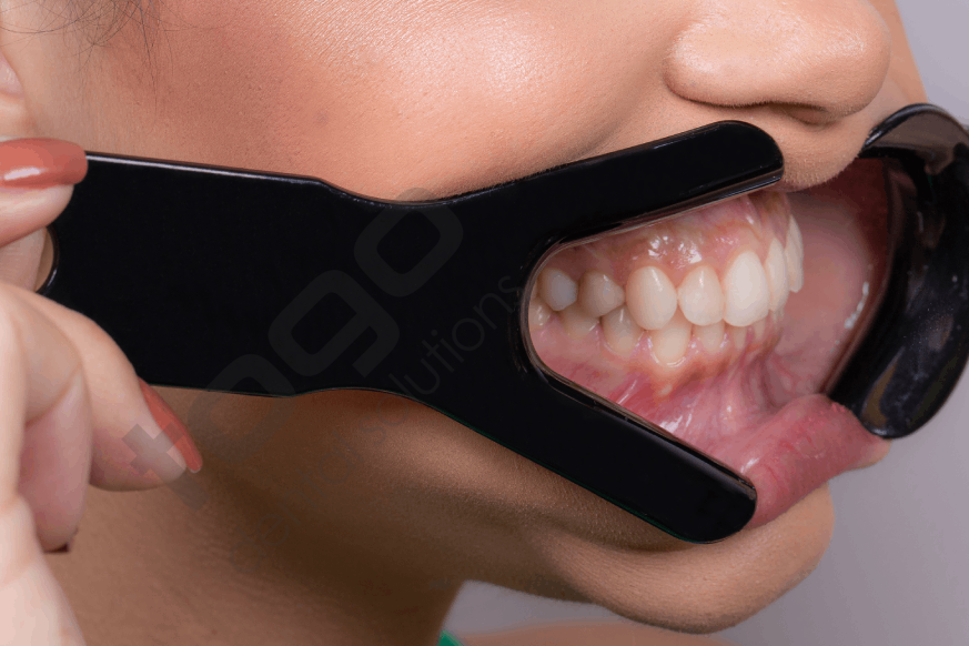 Indusbello Dental Fotoğrafçılık Ekartör Model:V