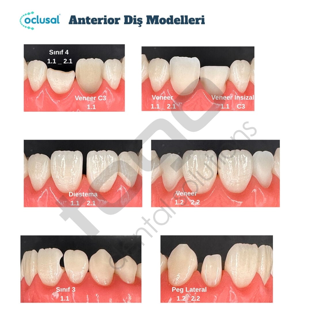 P-Oclusal Anterior Diş Eğitim Modelleri