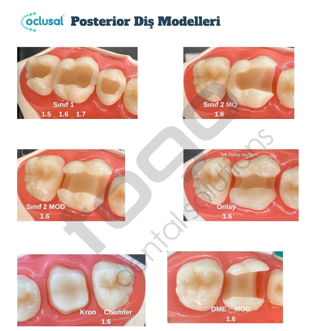 P-Oclusal Posterior Diş Eğitim Modelleri